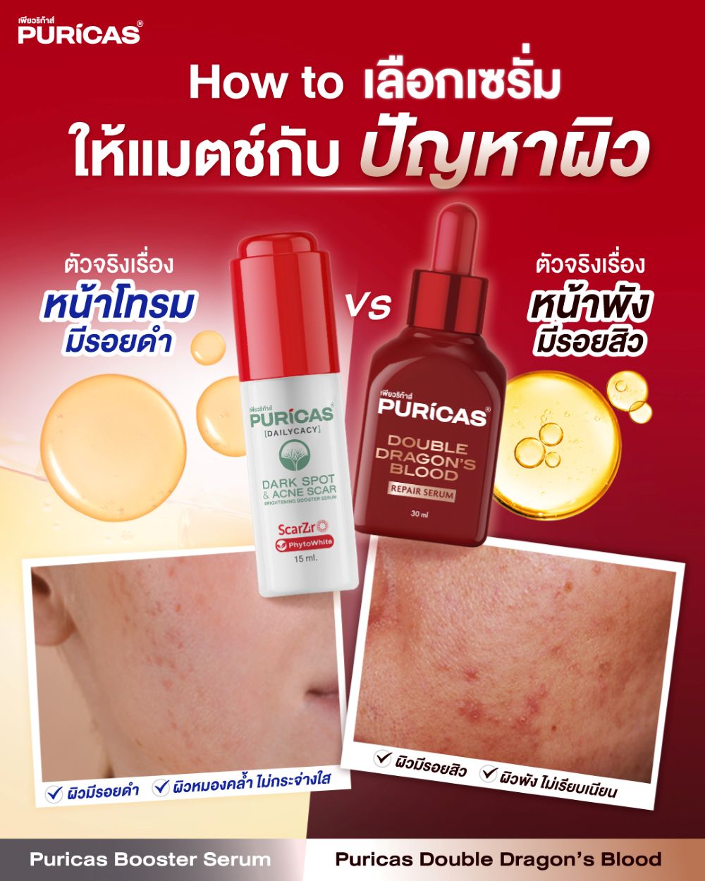 Puricas Dark Spot & Acne Scar Brightening Booster Serum 15ml, Puricas  ราคา ,Puricas  รีวิว , Puricas รอยดำ , Puricas  รอยสิว